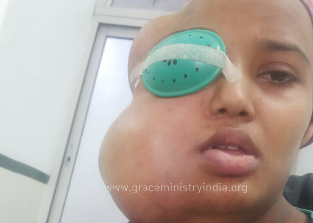 Dear readers, your charity help will save the life of Divya from Bangalore, who is experiencing a rare disease called Myxoid Liposarcoma. Your support will save her life. 